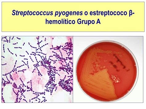 estreptococo beta hemolitico grupo a